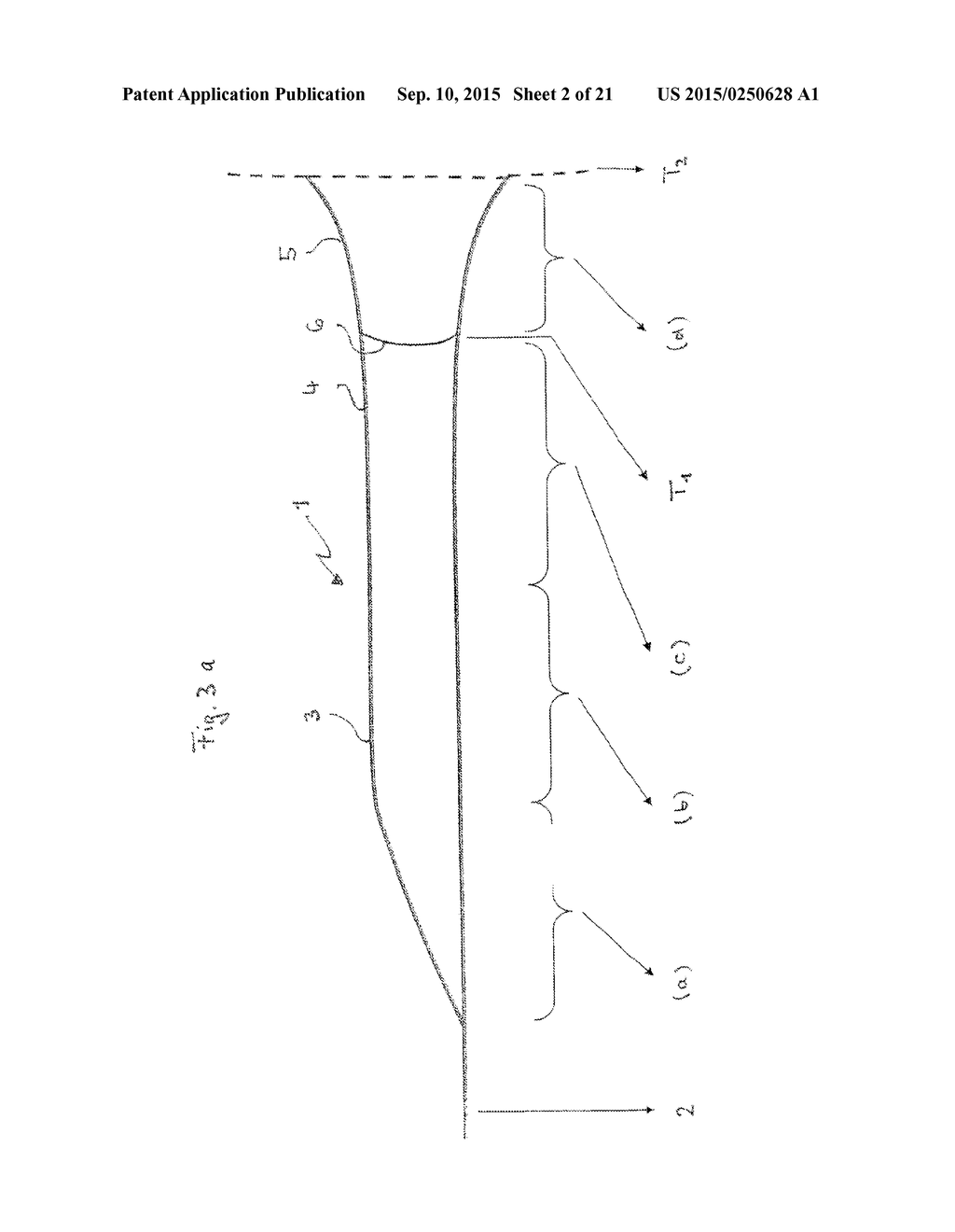 IMPLANT - diagram, schematic, and image 03