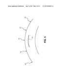 METHODS OF CORRECTING VISION diagram and image