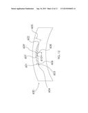 METHODS OF CORRECTING VISION diagram and image