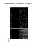 RNA TRANS-SPLICING MOLECULE (RTM) FOR USE IN THE TREATMENT OF CANCER diagram and image