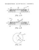 WOUND DRESSING WITH MICROPUMP diagram and image