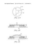 WOUND DRESSING WITH MICROPUMP diagram and image