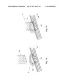 IRRIGATION/ASPIRATION SYSTEM, CARTRIDGE, PUMP UNIT, SURGICAL MACHINE,     METHOD FOR CONTROLLING diagram and image