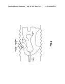 ADJUSTING A POSITION OF A HEATING WIRE WITHIN A BREATHING CIRCUIT diagram and image