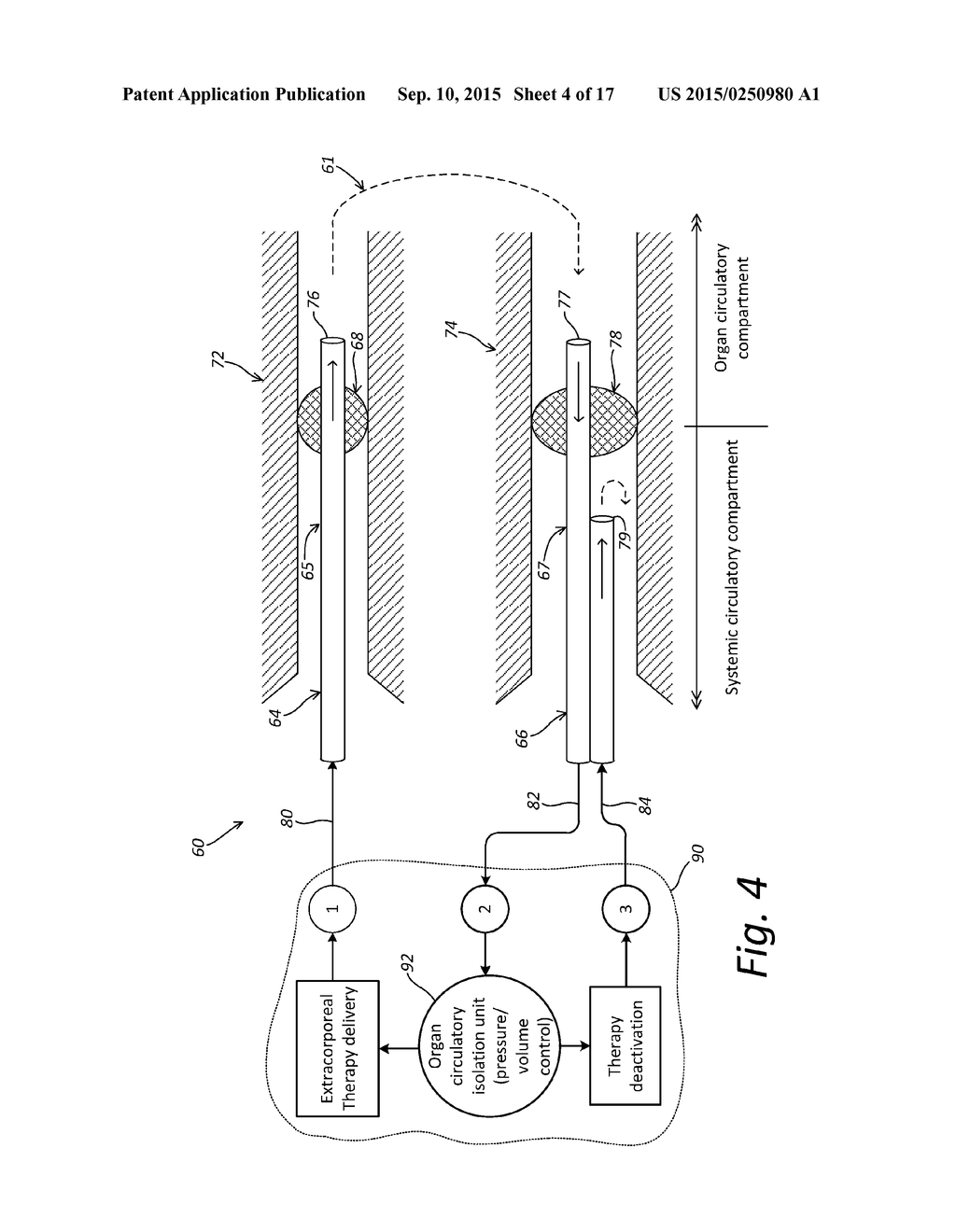 Localized Therapy Delivery and Local Organ Protection - diagram, schematic, and image 05