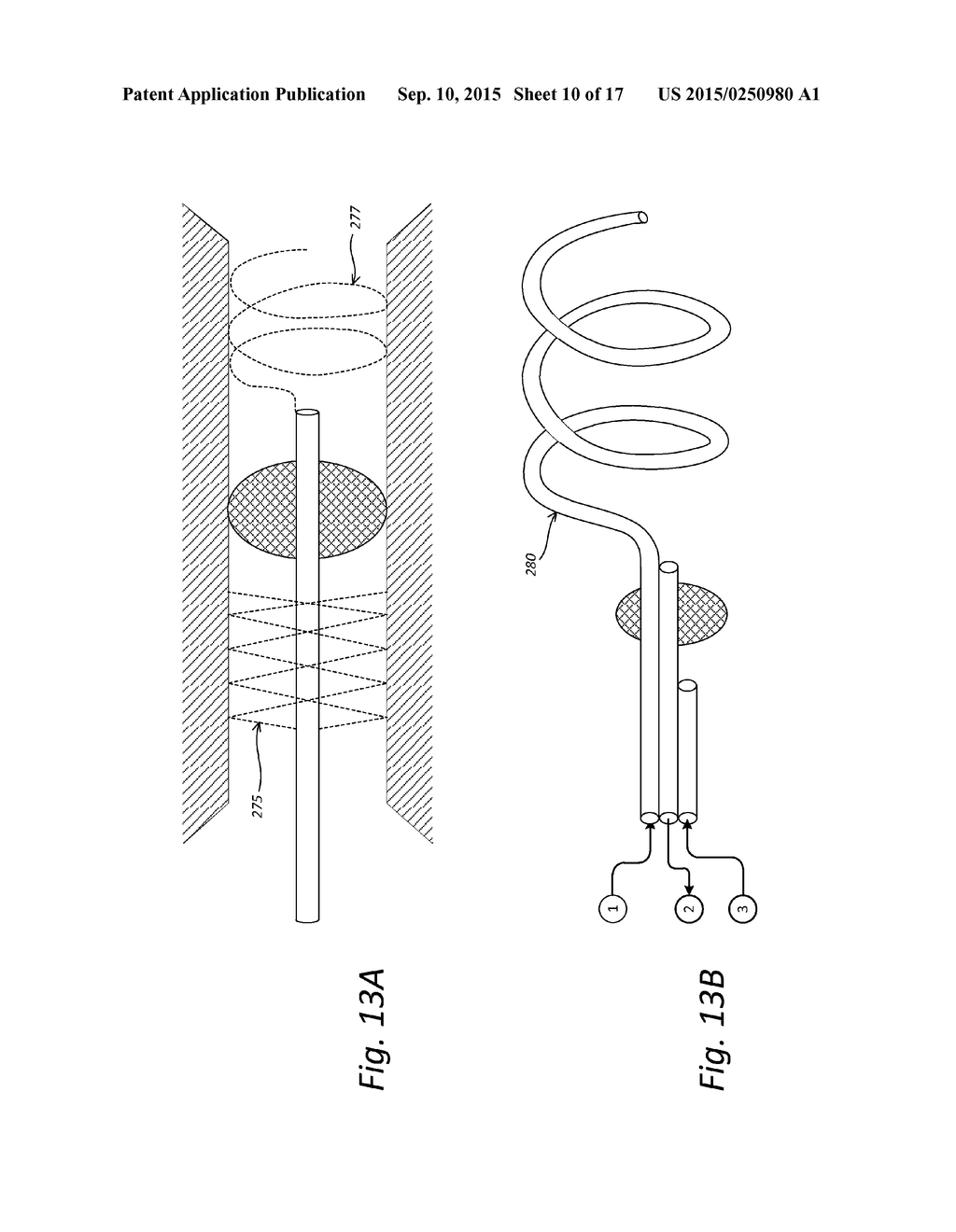 Localized Therapy Delivery and Local Organ Protection - diagram, schematic, and image 11