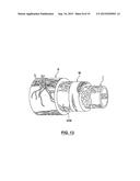 Catheter Assemblies and Methods for Stabilizing a Catheter Assembly Within     a Subintimal Space diagram and image