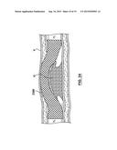 Catheter Assemblies and Methods for Stabilizing a Catheter Assembly Within     a Subintimal Space diagram and image