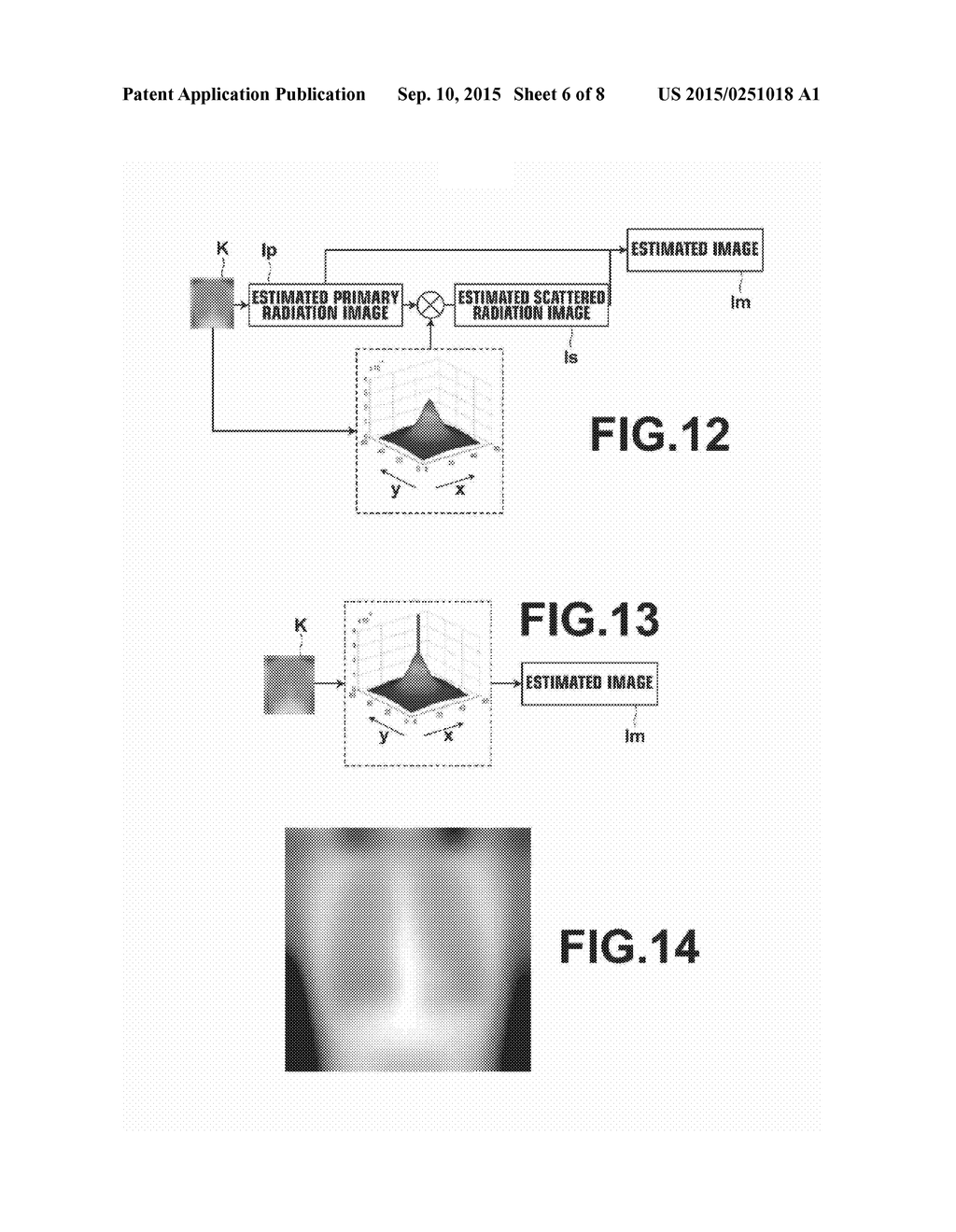 RADIATION IMAGE PROCESSING APPARATUS, METHOD, AND MEDIUM - diagram, schematic, and image 07