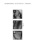 NANO SEEDING TOOLS TO GENERATE NANOMETER SIZE CRYSTALLIZATION SEEDS diagram and image