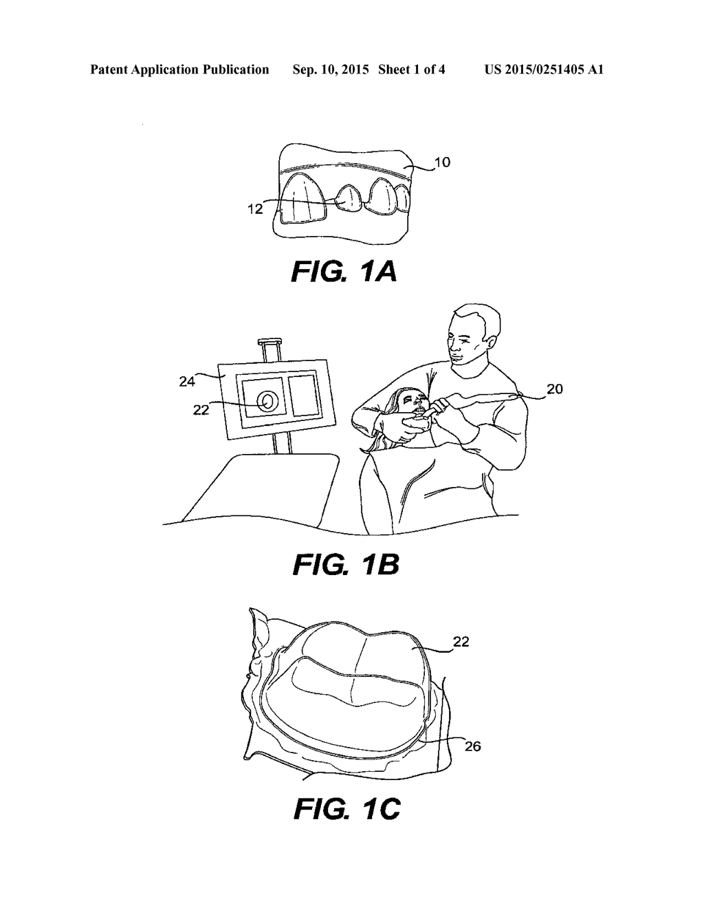 METHOD AND SYSTEM FOR FABRICATING A DENTAL COPING, AND A COPING FABRICATED     THEREBY - diagram, schematic, and image 02