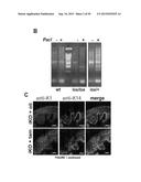 ACTIVATION OF TRPV4 ION CHANNEL BY PHYSICAL STIMULI AND CRITICAL ROLE FOR     TRPV4 IN ORGAN-SPECIFIC INFLAMMATION AND ITCH diagram and image