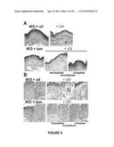ACTIVATION OF TRPV4 ION CHANNEL BY PHYSICAL STIMULI AND CRITICAL ROLE FOR     TRPV4 IN ORGAN-SPECIFIC INFLAMMATION AND ITCH diagram and image