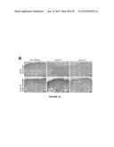 ACTIVATION OF TRPV4 ION CHANNEL BY PHYSICAL STIMULI AND CRITICAL ROLE FOR     TRPV4 IN ORGAN-SPECIFIC INFLAMMATION AND ITCH diagram and image