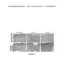 ACTIVATION OF TRPV4 ION CHANNEL BY PHYSICAL STIMULI AND CRITICAL ROLE FOR     TRPV4 IN ORGAN-SPECIFIC INFLAMMATION AND ITCH diagram and image