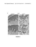 ACTIVATION OF TRPV4 ION CHANNEL BY PHYSICAL STIMULI AND CRITICAL ROLE FOR     TRPV4 IN ORGAN-SPECIFIC INFLAMMATION AND ITCH diagram and image