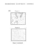 METHODS AND COMPOSITIONS FOR THE DIAGNOSIS, PROGNOSIS AND TREATMENT OF     CANCER diagram and image