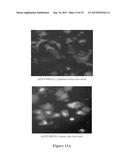 METHODS AND COMPOSITIONS FOR THE DIAGNOSIS, PROGNOSIS AND TREATMENT OF     CANCER diagram and image