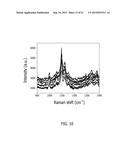 LABEL-FREE DETECTION OF RENAL CANCER diagram and image