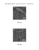 LABEL-FREE DETECTION OF RENAL CANCER diagram and image