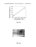 LABEL-FREE DETECTION OF RENAL CANCER diagram and image