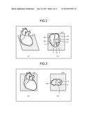 IMAGE PROCESSING APPARATUS, MAGNETIC RESONANCE IMAGING APPARATUS, AND     IMAGE PROCESSING METHOD diagram and image