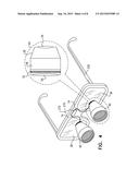 NARROW BAND IMAGING WITH SURGICAL LOUPES diagram and image