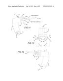 CAMERA MOUTH MOUNT diagram and image