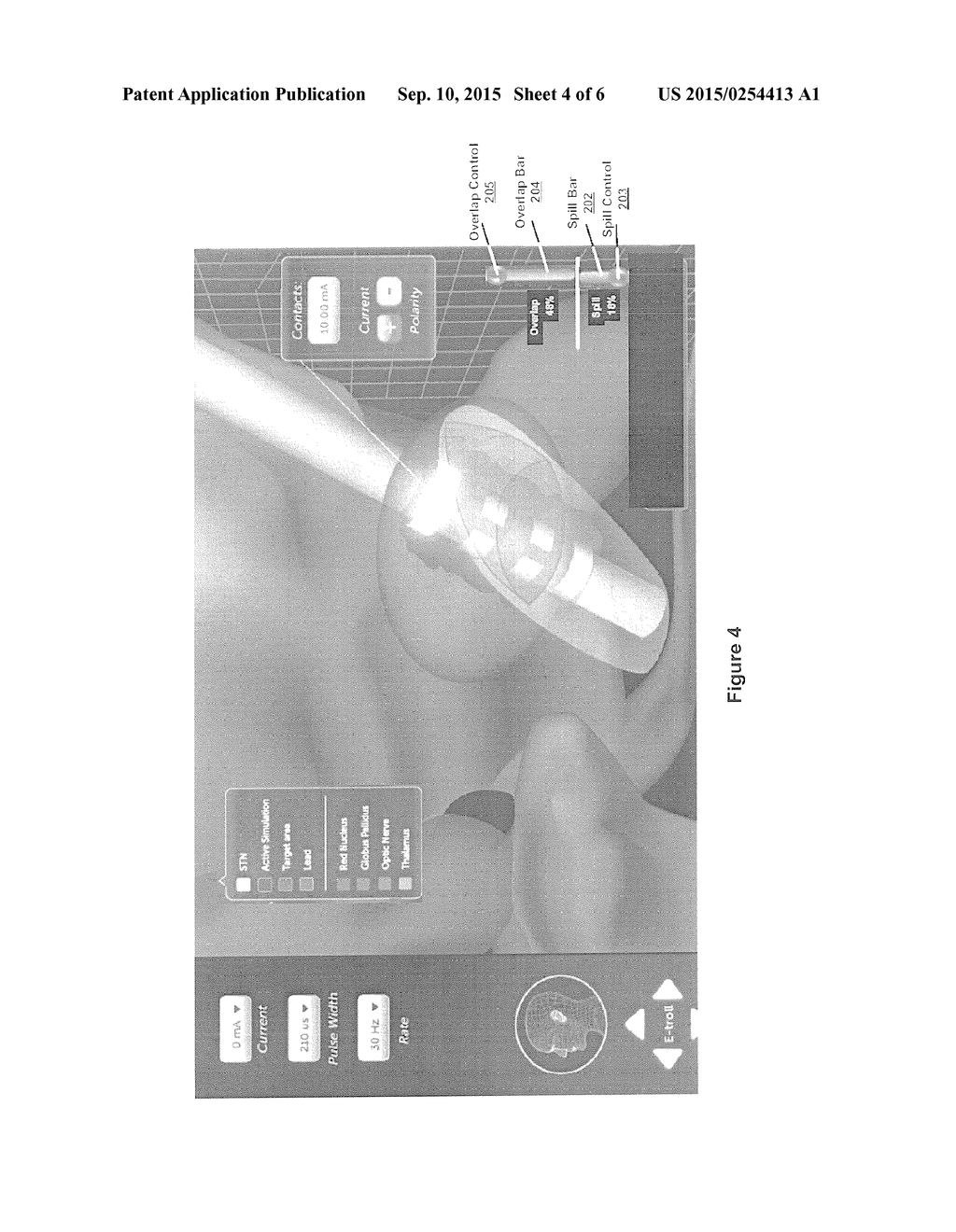 STIMULATION LEADWIRE AND VOLUME OF ACTIVATION CONTROL AND DISPLAY     INTERFACE - diagram, schematic, and image 05