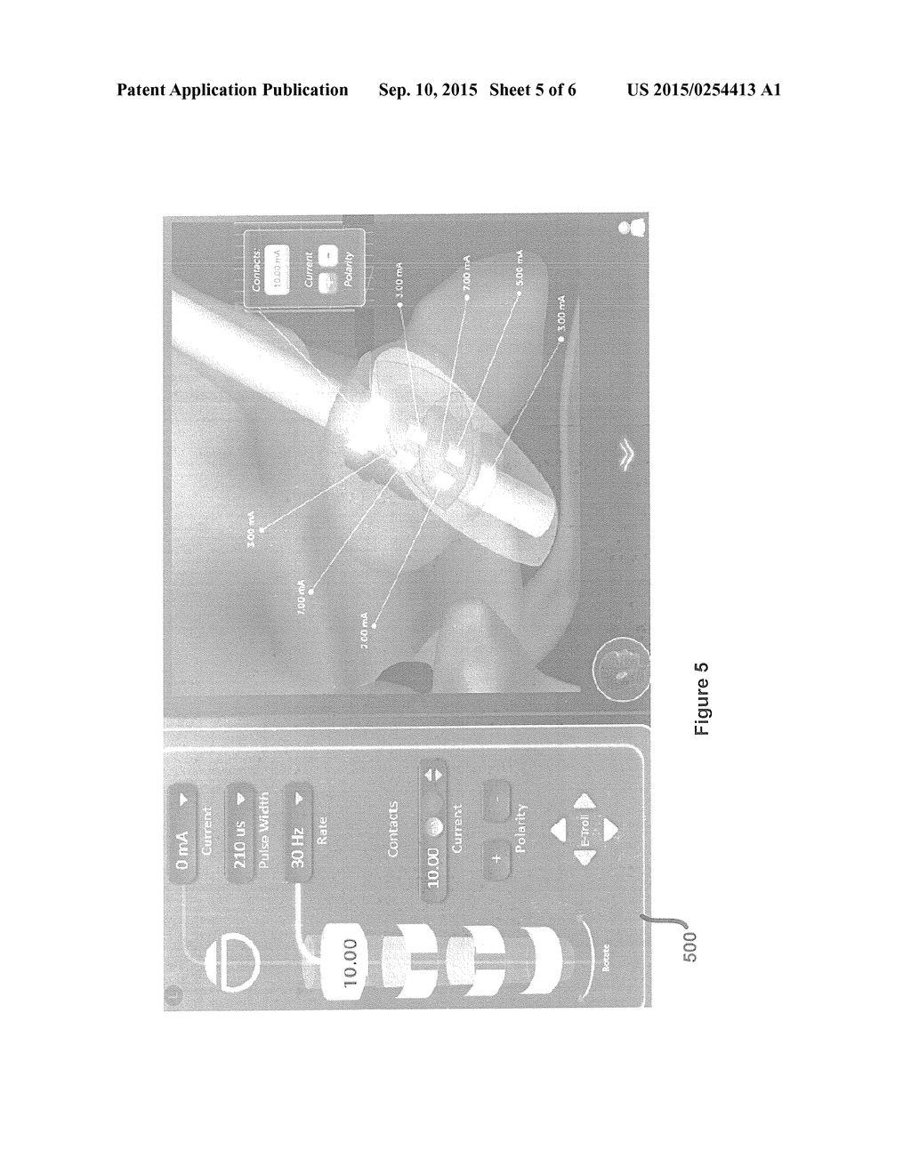 STIMULATION LEADWIRE AND VOLUME OF ACTIVATION CONTROL AND DISPLAY     INTERFACE - diagram, schematic, and image 06