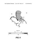 METHODS AND SYSTEMS FOR PREDICTING SENSITIVITY OF BLOOD FLOW CALCULATIONS     TO CHANGES IN ANATOMICAL GEOMETRY diagram and image