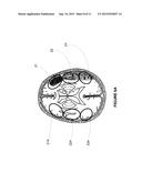 SYSTEMS AND METHODS FOR DIAGNOSING STROKES diagram and image