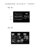 APPARATUS FOR PROCESSING MEDICAL IMAGE AND METHOD OF PROCESSING MEDICAL     IMAGE BY USING THE APPARATUS diagram and image