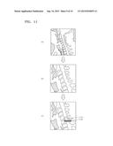 APPARATUS FOR PROCESSING MEDICAL IMAGE AND METHOD OF PROCESSING MEDICAL     IMAGE BY USING THE APPARATUS diagram and image