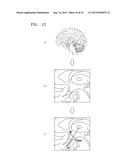 APPARATUS FOR PROCESSING MEDICAL IMAGE AND METHOD OF PROCESSING MEDICAL     IMAGE BY USING THE APPARATUS diagram and image