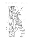 Picking Unit, Harvesting Attachment and Harvester for Corn or Similar diagram and image