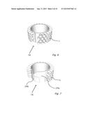 WRIST PROTECTION AND SUPPORT MECHANISM diagram and image