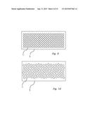 WRIST PROTECTION AND SUPPORT MECHANISM diagram and image