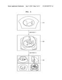 MEDICAL DIAGNOSTIC APPARATUS AND OPERATING METHOD THEREOF diagram and image