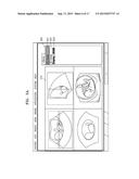 MEDICAL DIAGNOSTIC APPARATUS AND OPERATING METHOD THEREOF diagram and image