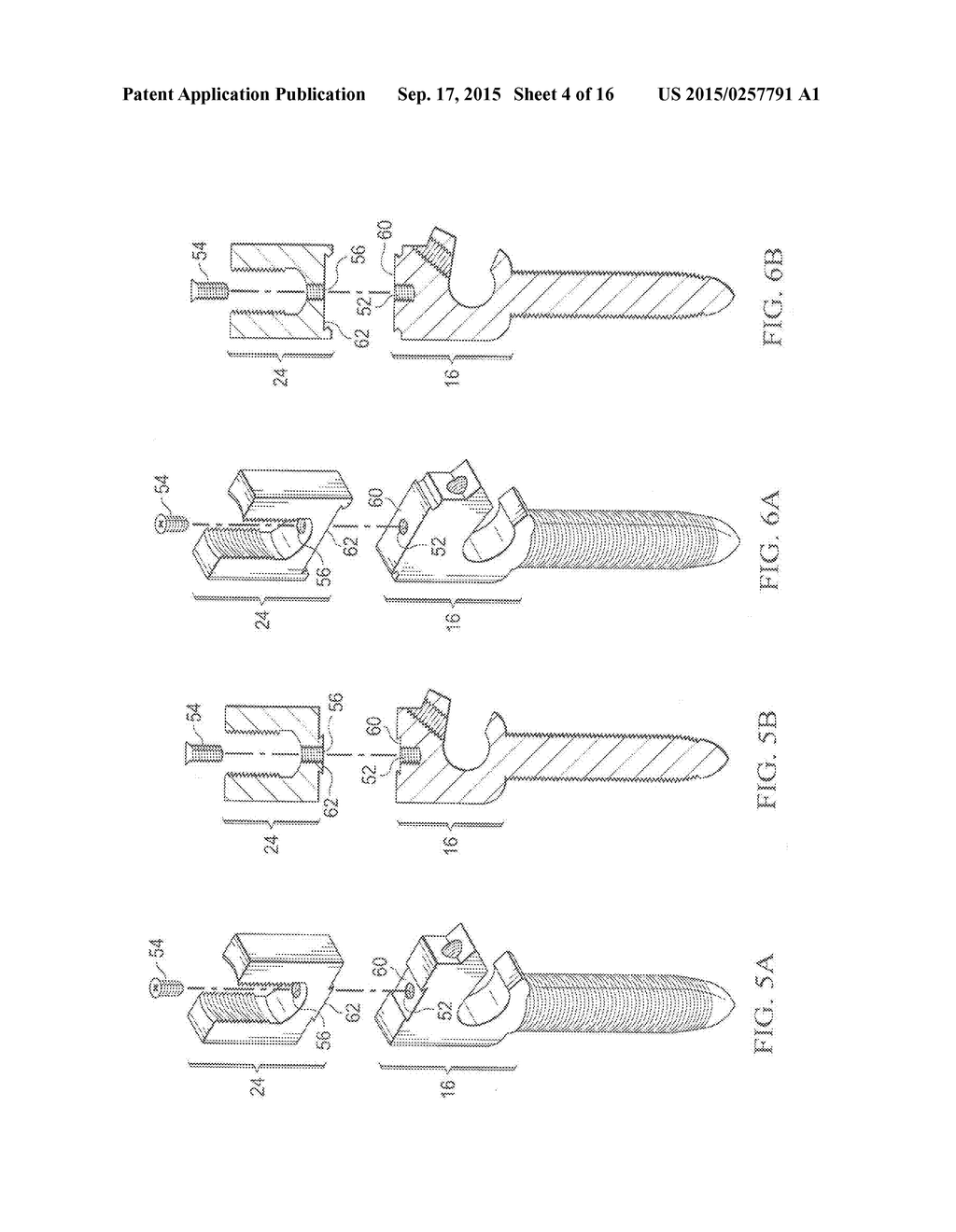 Pedicle Screw - diagram, schematic, and image 05