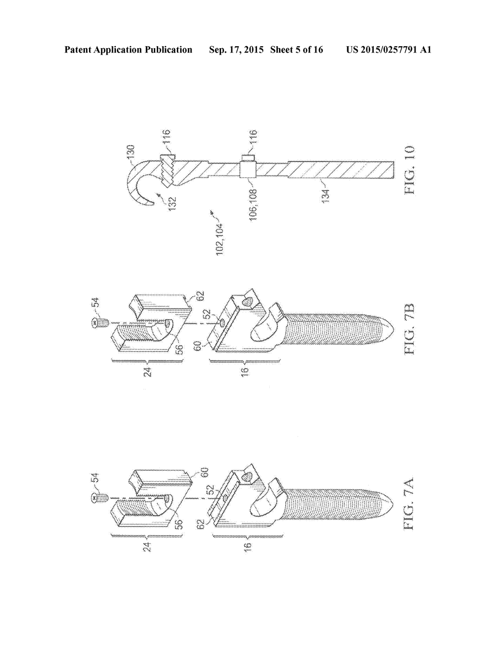 Pedicle Screw - diagram, schematic, and image 06