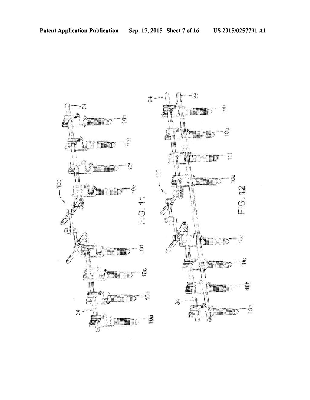 Pedicle Screw - diagram, schematic, and image 08