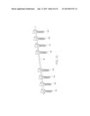 Pedicle Screw diagram and image