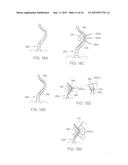 Pedicle Screw diagram and image