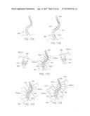 Pedicle Screw diagram and image