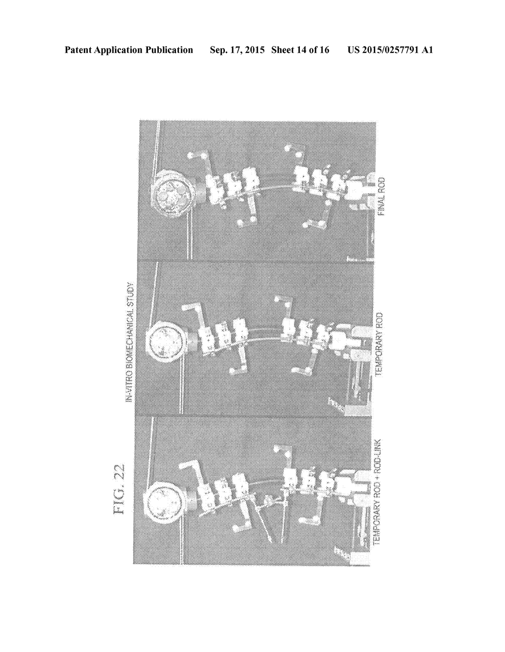 Pedicle Screw - diagram, schematic, and image 15