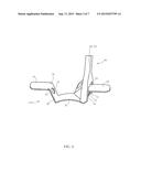 SPINAL IMPLANT SYSTEM AND METHODS OF USE diagram and image