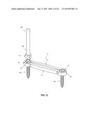 PLATES FOR GENERATING, APPLYING AND MAINTAINING COMPRESSION WITHIN A BODY diagram and image