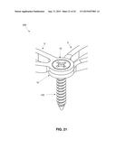 PLATES FOR GENERATING, APPLYING AND MAINTAINING COMPRESSION WITHIN A BODY diagram and image